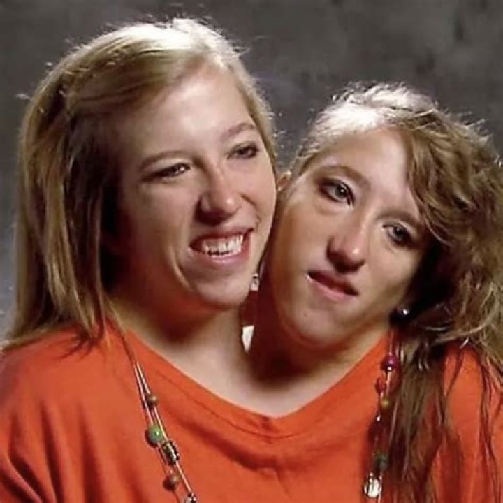 Abby And Brittany Hensel: An Amazing Life Of Conjoined Twins Today