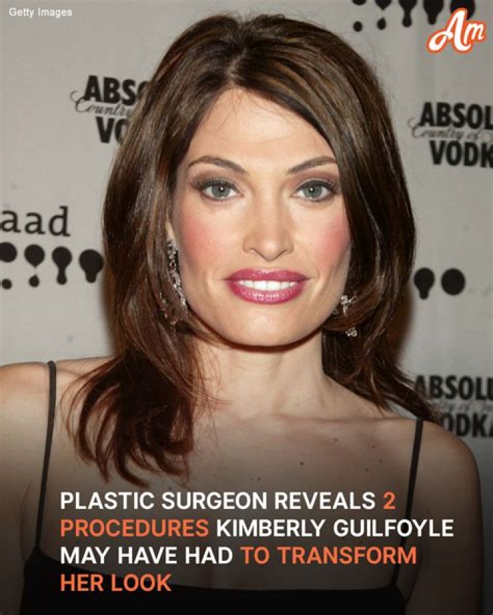 Exploring The Journey Of Fox Kimberly Guilfoyle Before Fame