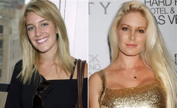 Kenny Johnson: A Journey Through Plastic Surgery