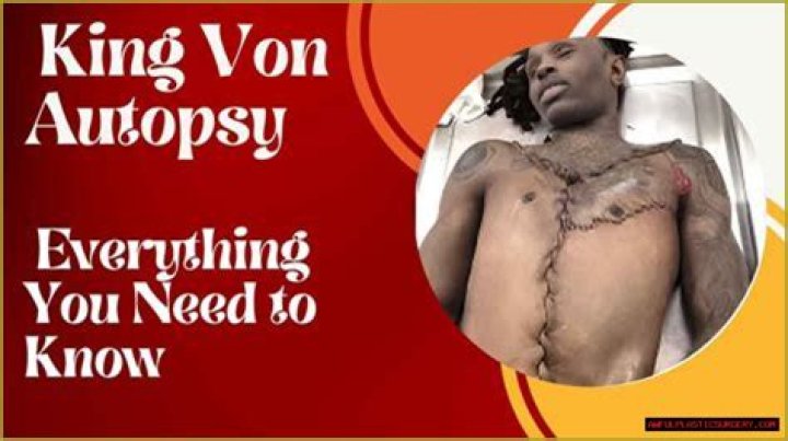 King Von: A Dive Into His Legal History