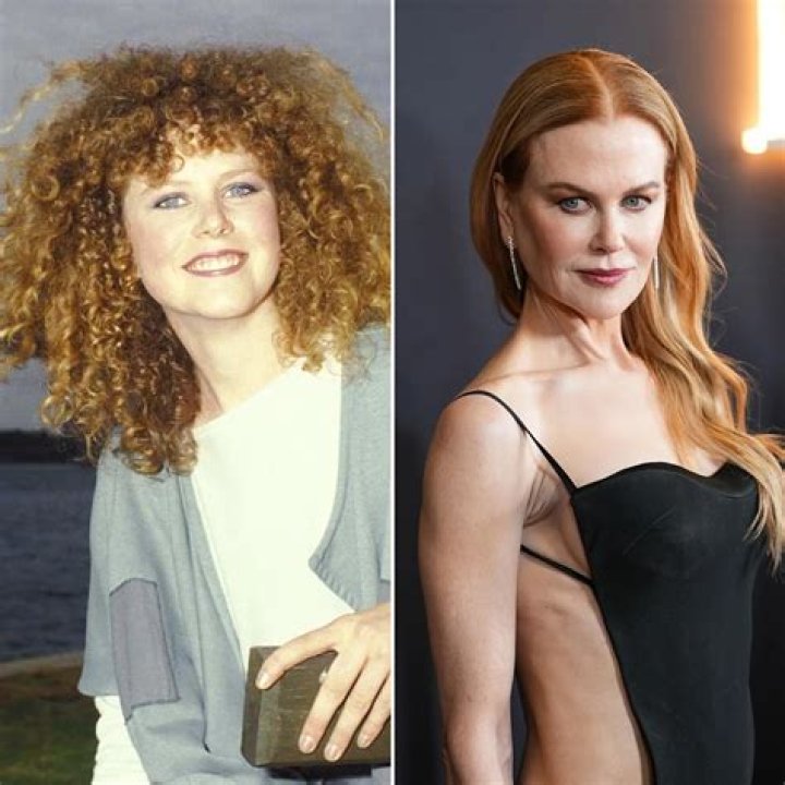 Nicole Kidman: Beauty And Transformation Before Botox