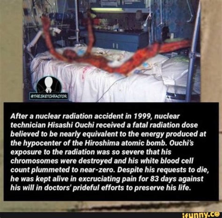 Nuclear Hisashi Ouchi Photos: A Glimpse Into Tragedy And Resilience