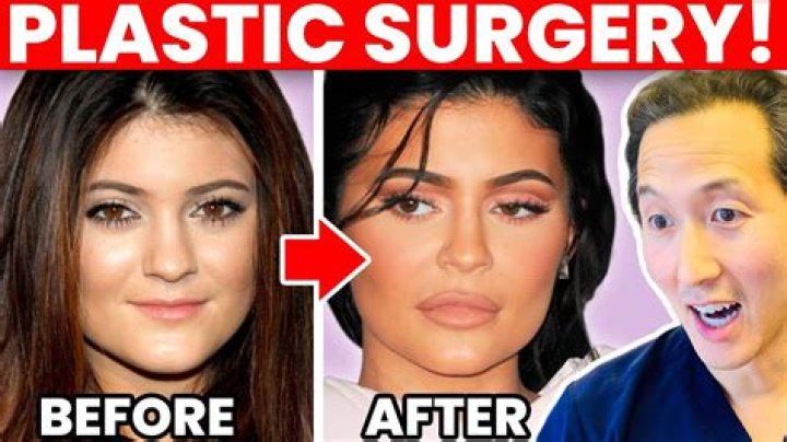 Remarkable Plastic Surgery Transformations By Lilli Kay