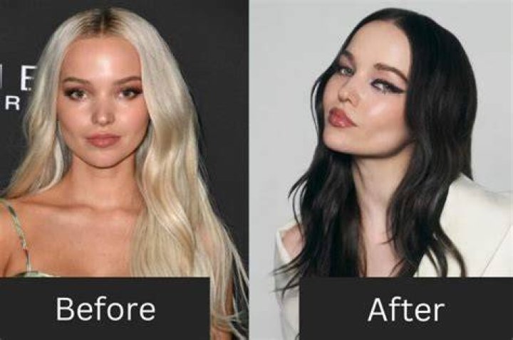 Sabrina Carpenter: A Glimpse Into Her Life Before Plastic Surgery
