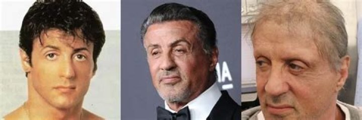 Sylvester Stallone's Iconic Hair: A Journey Through Time