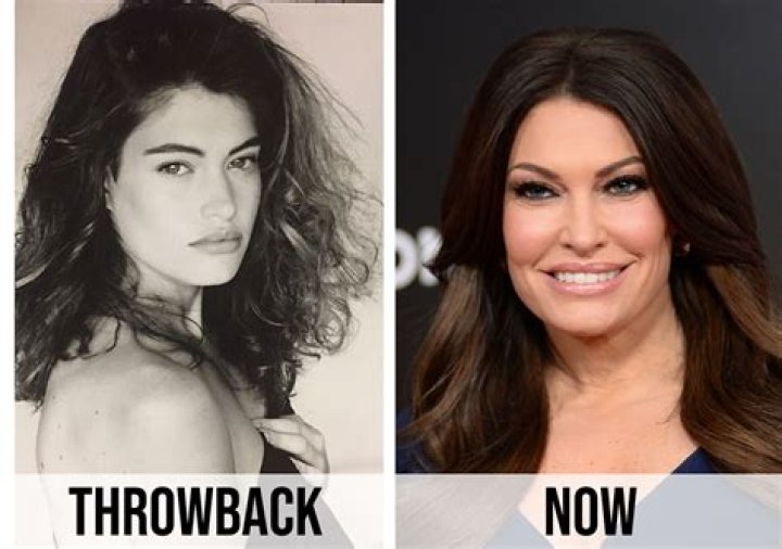 The Ultimate Guide To Kim Guilfoyle's Botox Procedure