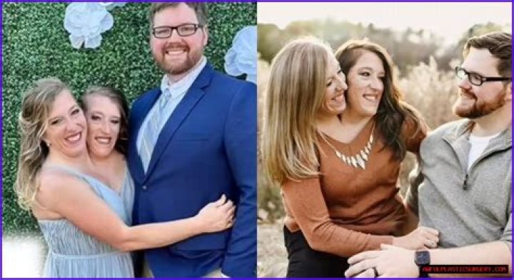 Understanding The Abby And Brittany Hensel Family Tragedy Update