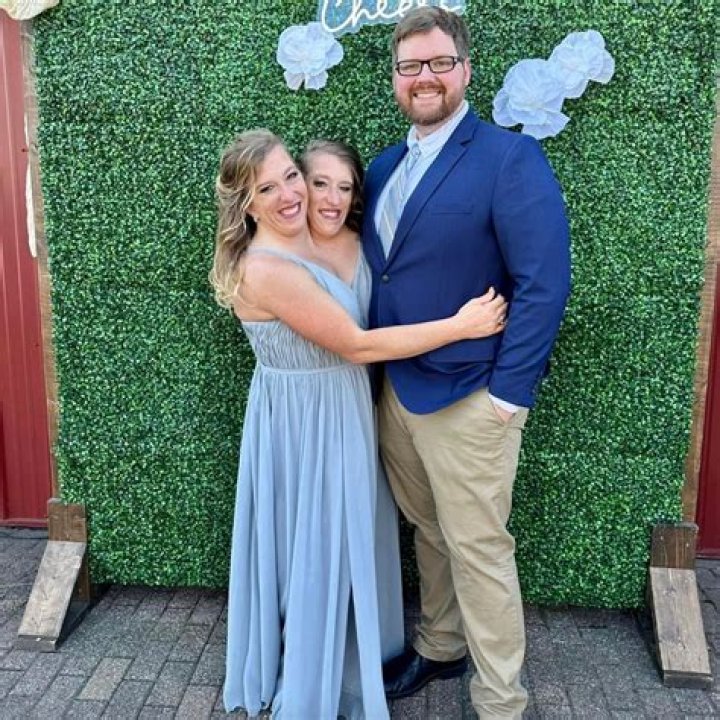 Understanding The Hensel Twins Sad News: A Deep Dive Into Their Journey