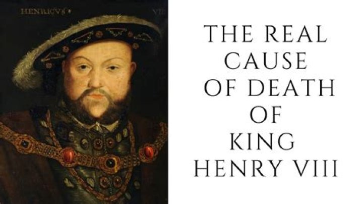 Unraveling The Mystery: Kingface Cause Of Death Autopsy