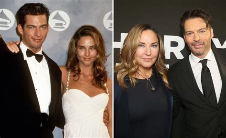Unraveling The Mystery: What Happened To Harry Connick Jr’s Face?