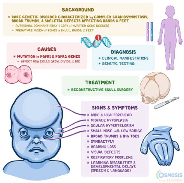 Unveiling Anant Ambani Syndrome: Causes And Treatment Options