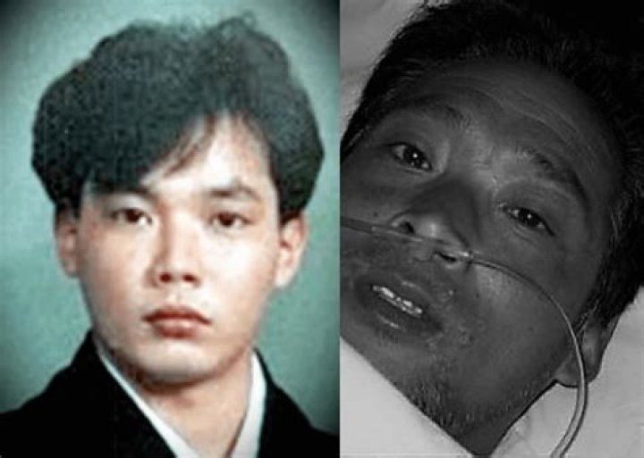 Unveiling The Tragic Story Of Hisashi Ouchi: A Journey Through His Body Images