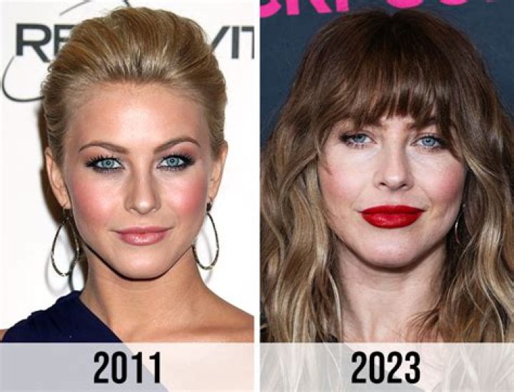 Unveiling The Truth Behind Julianne Hough's Plastic Surgery Journey